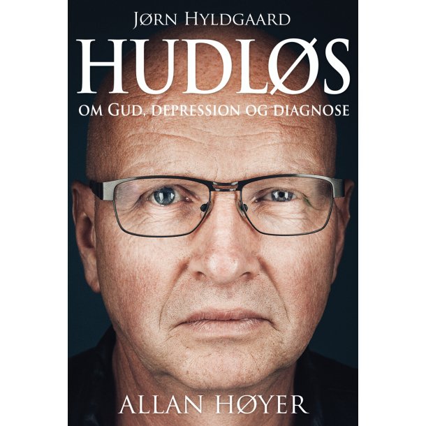 Hudls - Jrn Hyldgaard